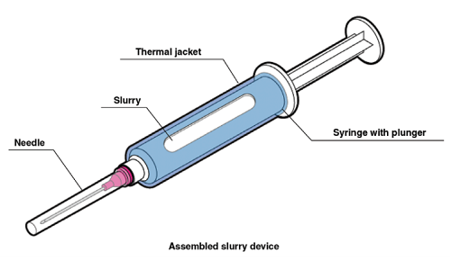 Ice Slurry Syringe. This syringe added a protective film that prevents temperature drop on the standard syringe. The injection needle uses a 14 to 15 gauge (Source = Plast Reconstr Surg Glob Open 2021;9:e3818).